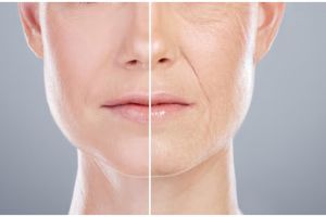 Cara pudarkan keriput agar wajah tetap kencang pakai 1 jenis tepung, umur 50 jadi tampak 30 tahun