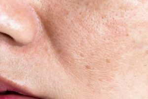 Cara bikin wajah kusam jadi glowing paripurna dengan 1 jenis buah, auto glowing dalam sekejap