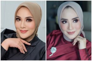 Lelah jalani perawatan wajah rutin, begini cerita Elma Theana putuskan oplas di usia 50 tahun