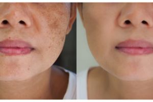 Cara bikin wajah kusam jadi glowing cuma pakai 1 jenis buah, kulit mulus bak oplas