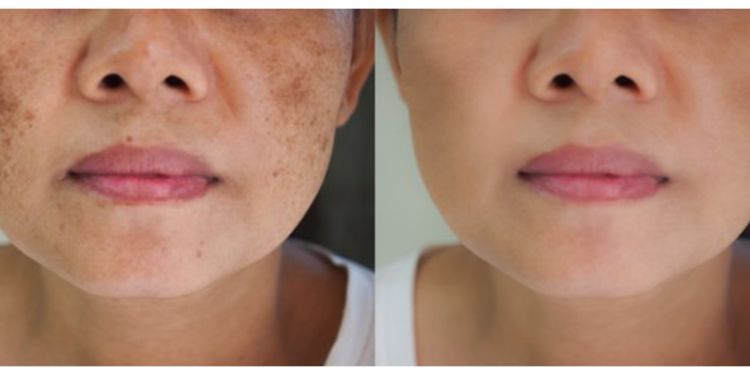 Cara bikin wajah kusam jadi glowing cuma pakai 1 jenis buah, kulit mulus bak oplas