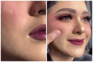 Jangan langsung pakai bedak, ini cara mudah atasi foundation retak di area smile line agar tersamarkan