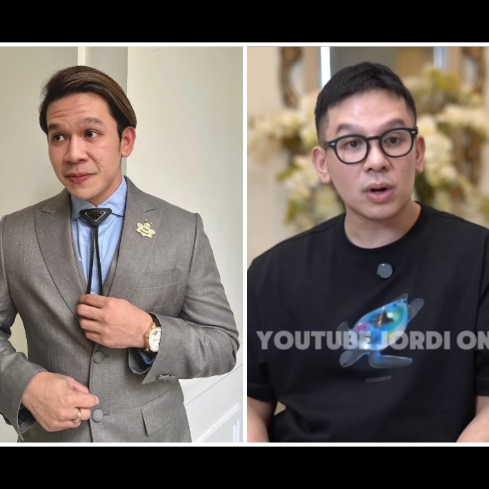 Pengakuan jujur Jordi Onsu sengaja operasi plastik demi estetika wajah, sampai habiskan ratusan juta