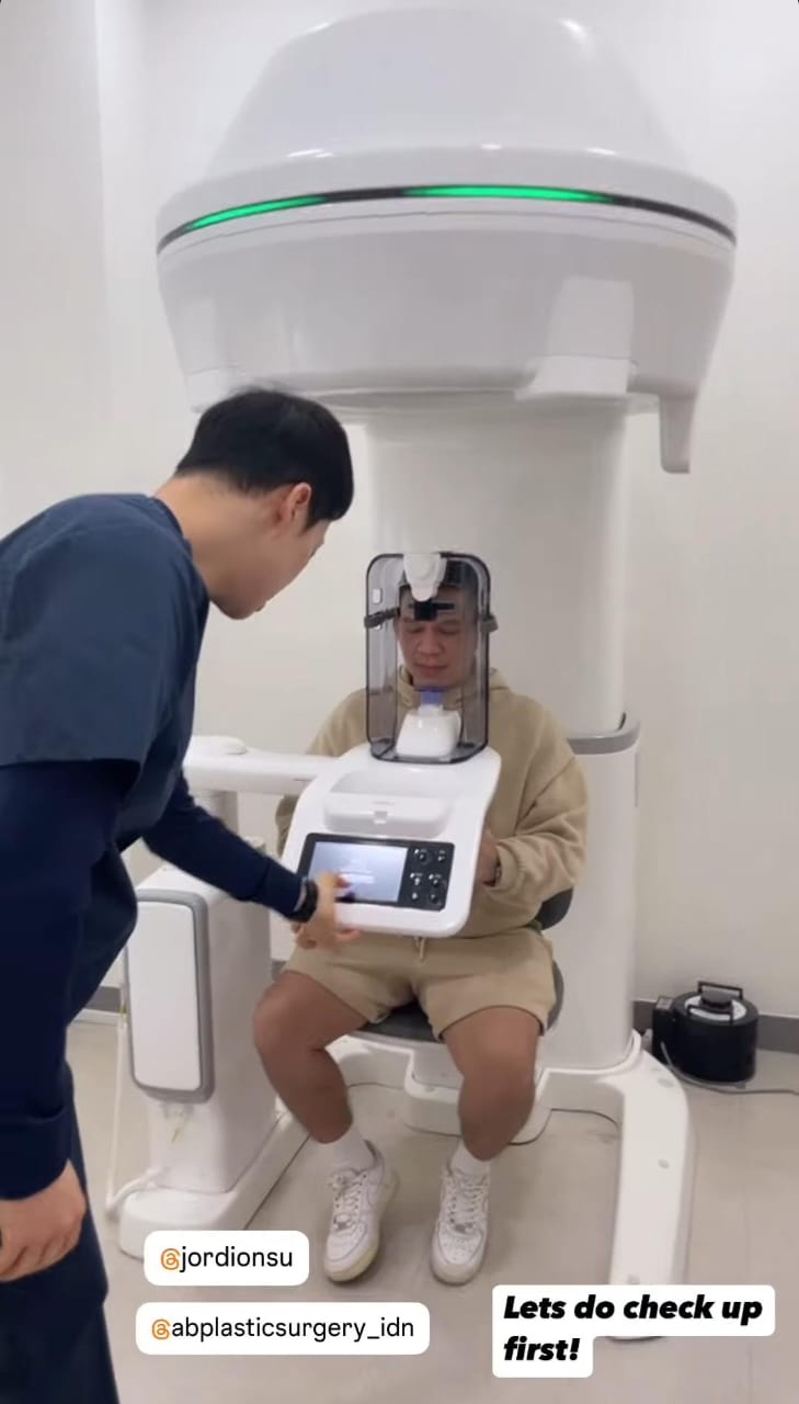 Permak wajah demi estetika, ini 7 potret Jordi Onsu sebelum dan sesudah oplas hidung di Korea Selatan