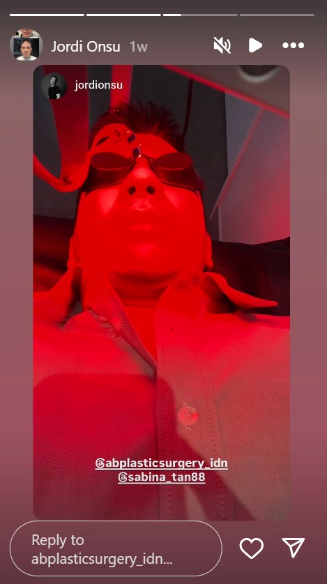 Permak wajah demi estetika, ini 7 potret Jordi Onsu sebelum dan sesudah oplas hidung di Korea Selatan