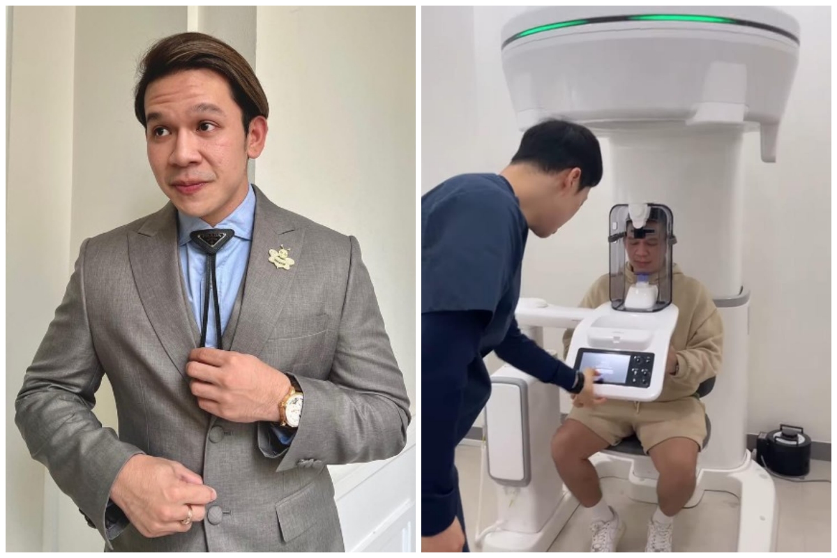 Permak wajah demi estetika, ini 7 potret Jordi Onsu sebelum dan sesudah oplas hidung di Korea Selatan