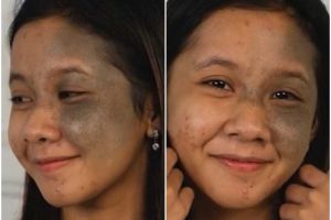 Hasilnya bikin lupa wajah asli, ini transformasi wanita punya bekas jerawat dan tompel usai dirias MUA