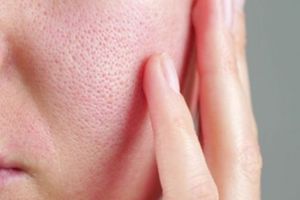 Cara bersihkan pori-pori wajah agar kulit terlihat mulus pakai 1 jenis tepung, wajah auto glowing 