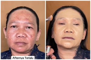 Natural meski pakai foundation tebal, transformasi wanita dengan flek hitam manglingi bak beda orang