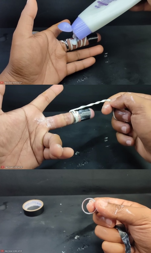 Melepas cincin kekecilan tanpa harus pakai sabun, begini triknya sekarang andalkan 1 alat sederhana