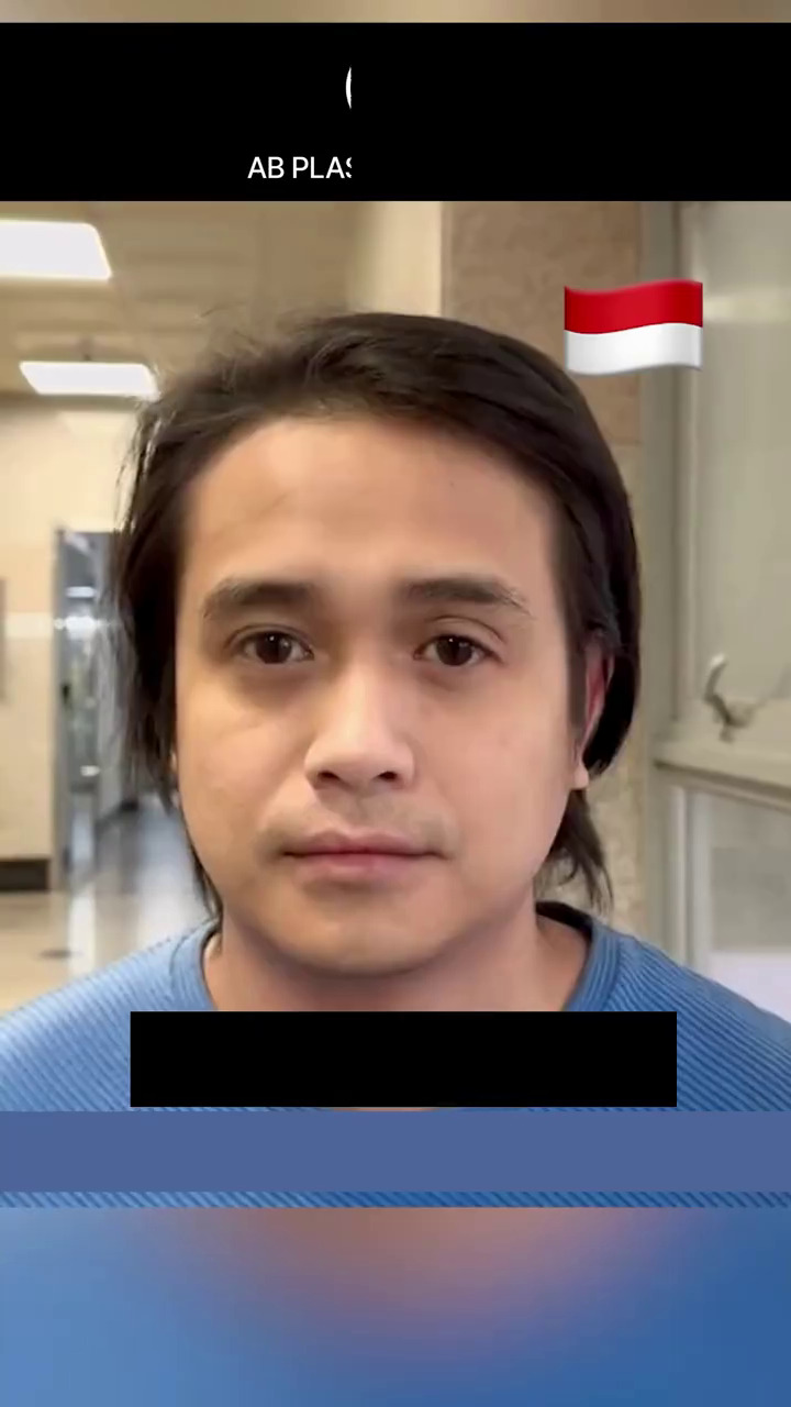 Wajah baru bikin salah fokus, ini 9 potret transformasi Ajun Perwira usai operasi plastik