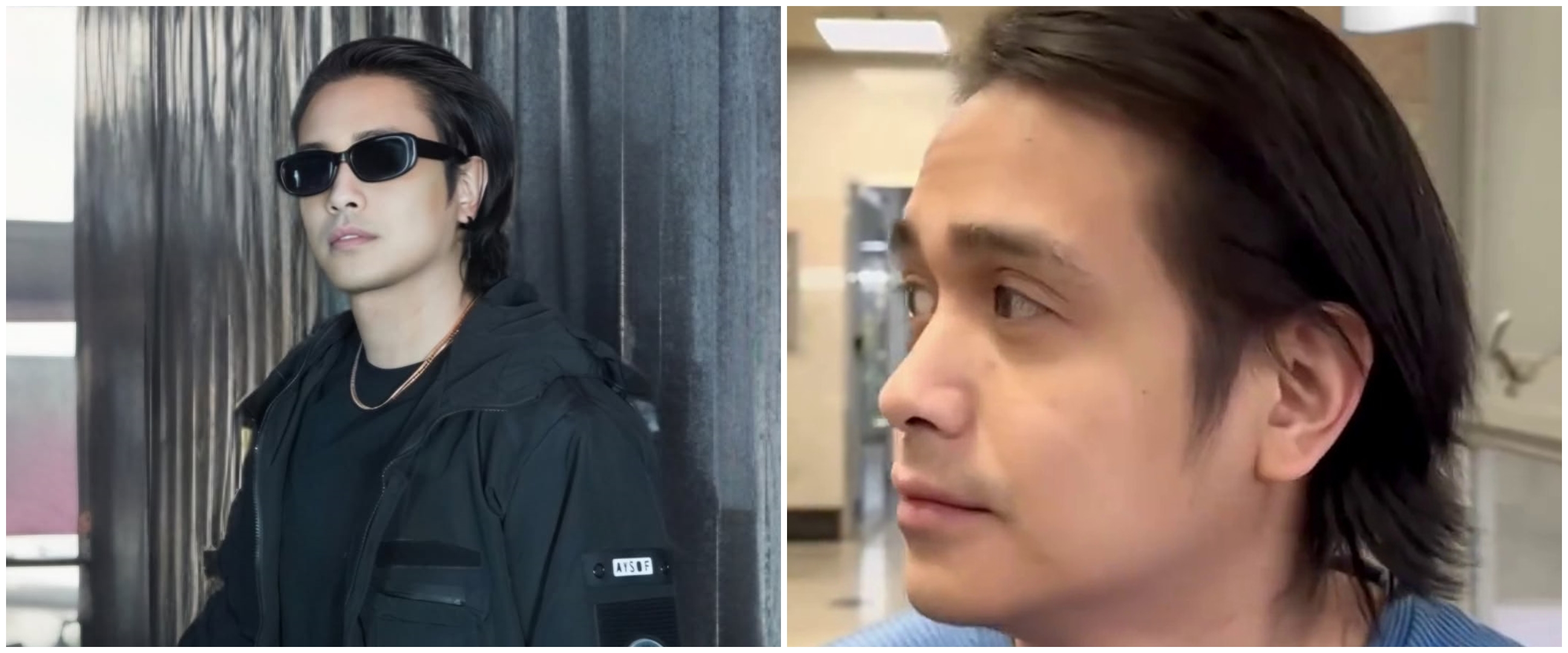 Wajah baru bikin salah fokus, ini 9 potret transformasi Ajun Perwira usai operasi plastik