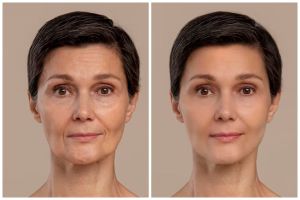 Tak perlu perawatan klinik, ini cara kencangkan kulit cuma pakai masker kolagen dari 2 jenis tepung