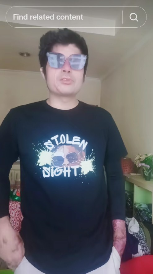 Ingat Agus Salim korban penyiraman air keras? Usai gagal dapat uang donasi begini profesinya sekarang