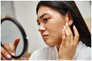 Cara baru atasi bruntusan secara alami pakai 2 bahan dapur, wajah halus bebas bintik kecil