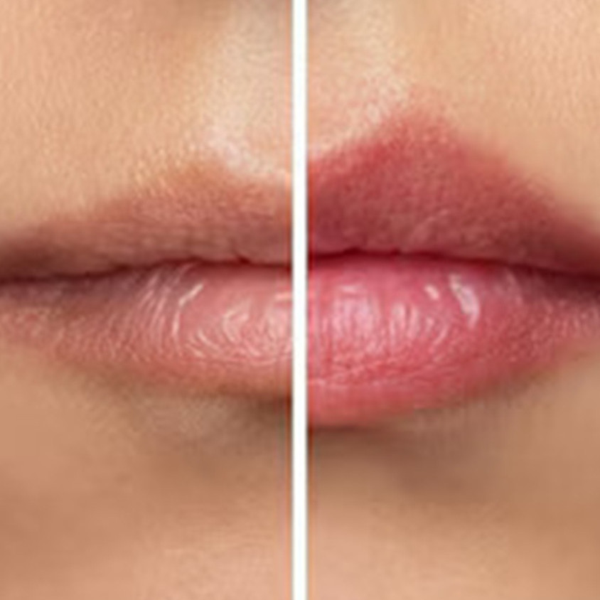 Cara bikin bibir hitam jadi pink alami pakai 1 jenis minuman, nggak perlu pakai lip balm