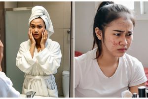Tanpa disadari, 5 kebiasaan harian ini bikin skincare-mu jadi sia-sia