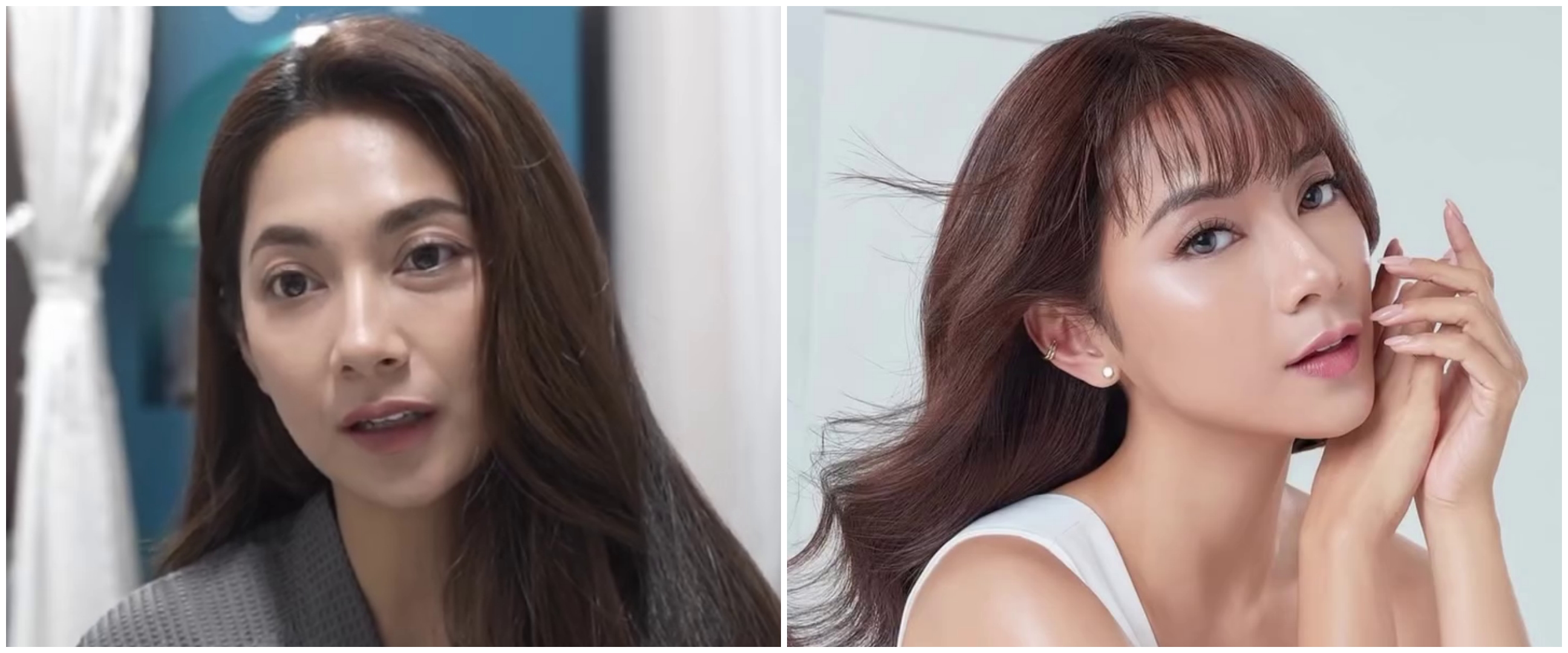 9 Transformasi Dinda Kirana jalani oplas wajah dan badan, hasilnya natural dan tampak lebih muda