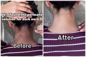 Cara eksfoliasi punggung leher gelap agar lebih cerah dan mulus dengan scrub dari 3 bahan dapur ini