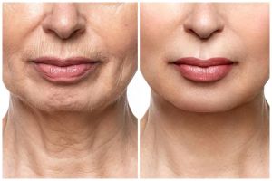 Wajah auto kencang lagi, ini cara ampuh pudarkan keriput cuma pakai masker dari 1 bahan minuman