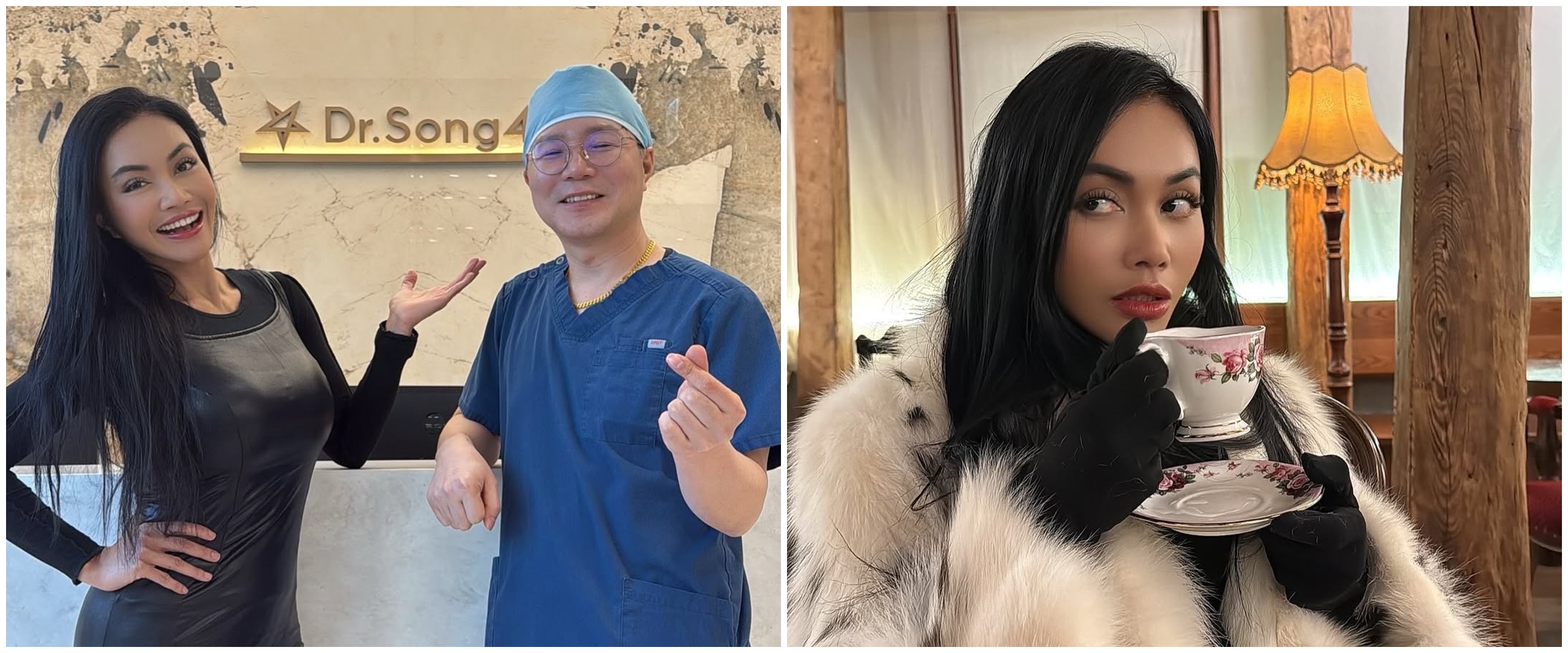 Sengaja operasi plastik kedua untuk cari suami, intip 9 potret penampilan terbaru Denada