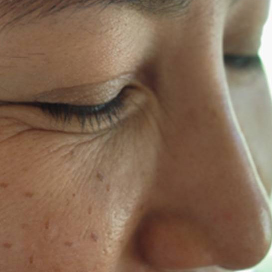 Hindari flek hitam akibat kosmetik bermerkuri, ini cara aman dan alami mengatasinya