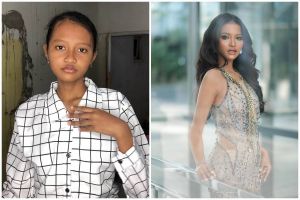 Definisi cantik nggak harus putih, 11 transformasi gadis lugu jadi supermodel ini manglingi pol
