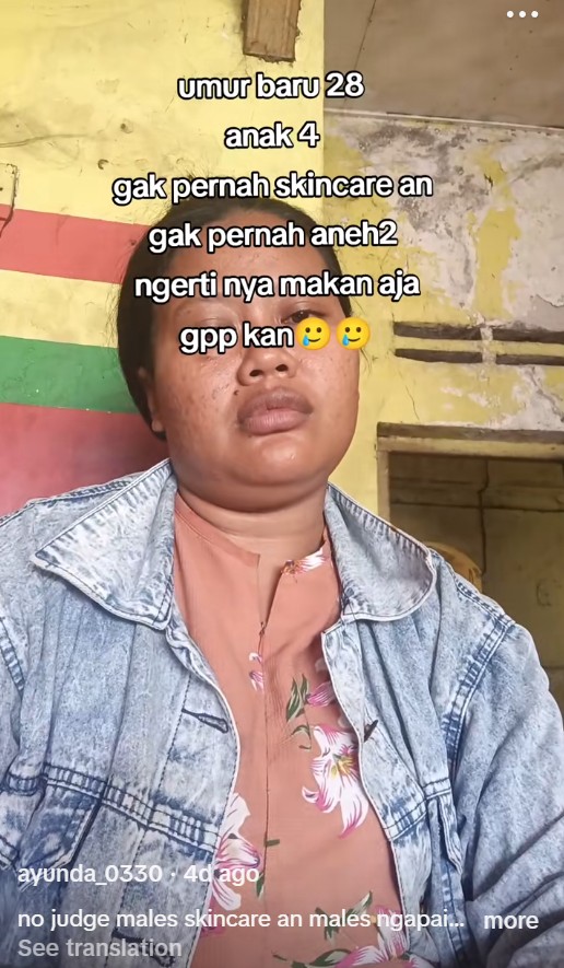 Alami perubahan penampilan usai KB implan, 9 transformasi wanita 28 tahun ini tampak seperti usia 40 