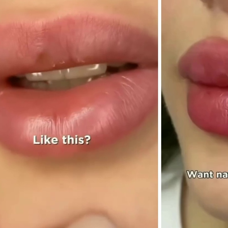 Lebih praktis dan ampuh, satu jenis buah ini bisa bikin bibir lembap dan merah alami bak difiller