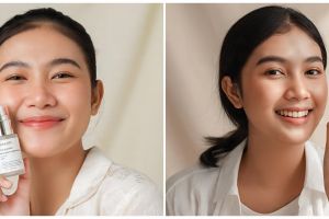 Kulit glowing dengan niacinamide, begini cara pakainya agar maksimal