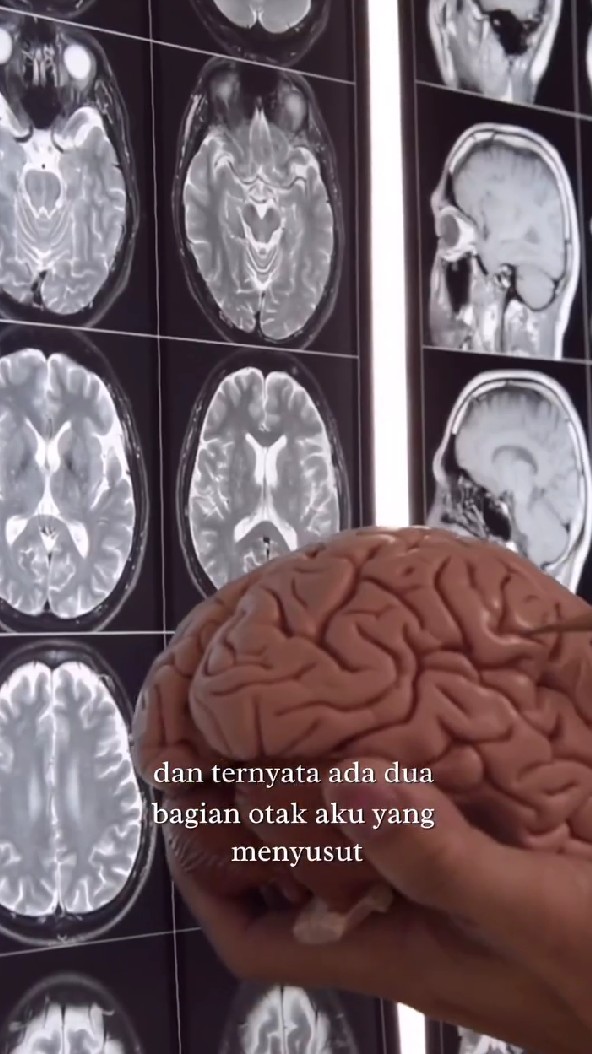 Baru 5 bulan berumah tangga, Aurelie Moeremans ungkap rasa sedih soal cobaan dalam pernikahannya