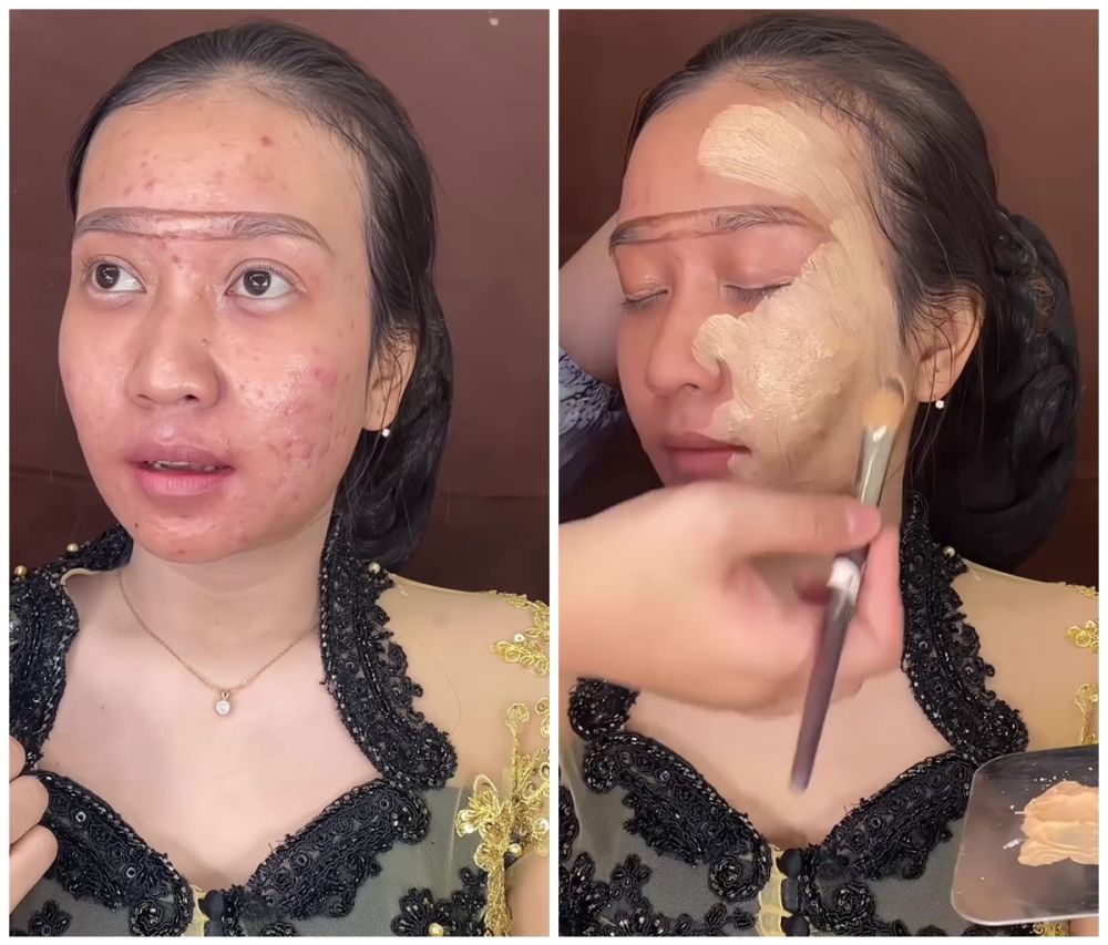 Transformasi makeup cewek breakout parah dirias tanpa foundation, nggak nyangka hasilnya bisa mulus