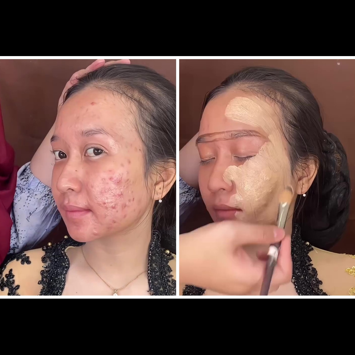 Transformasi makeup cewek breakout parah dirias tanpa foundation, nggak nyangka hasilnya bisa mulus