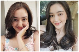 Punya freckles alami, ini trik Ranty Maria pakai complexion agar wajah lebih mulus bebas flek hitam