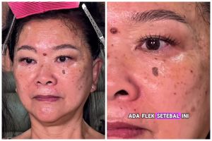 Dapat client dengan flek hitam pekat, MUA ini sukses ubah tampilannya jadi lebih mulus bak beda orang