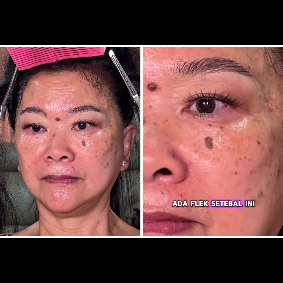 Dapat client dengan flek hitam pekat, MUA ini sukses ubah tampilannya jadi lebih mulus bak beda orang