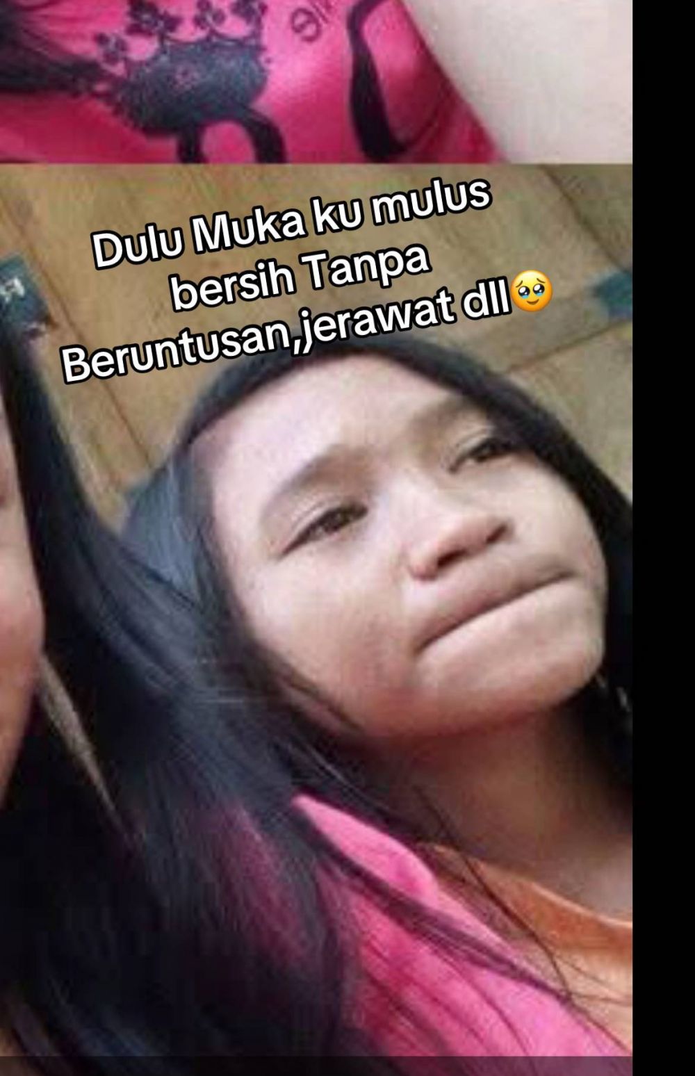 Menyesal pakai krim merkuri, 7 transformasi wajah wanita dulu mulus kini penuh bopeng ini bikin miris