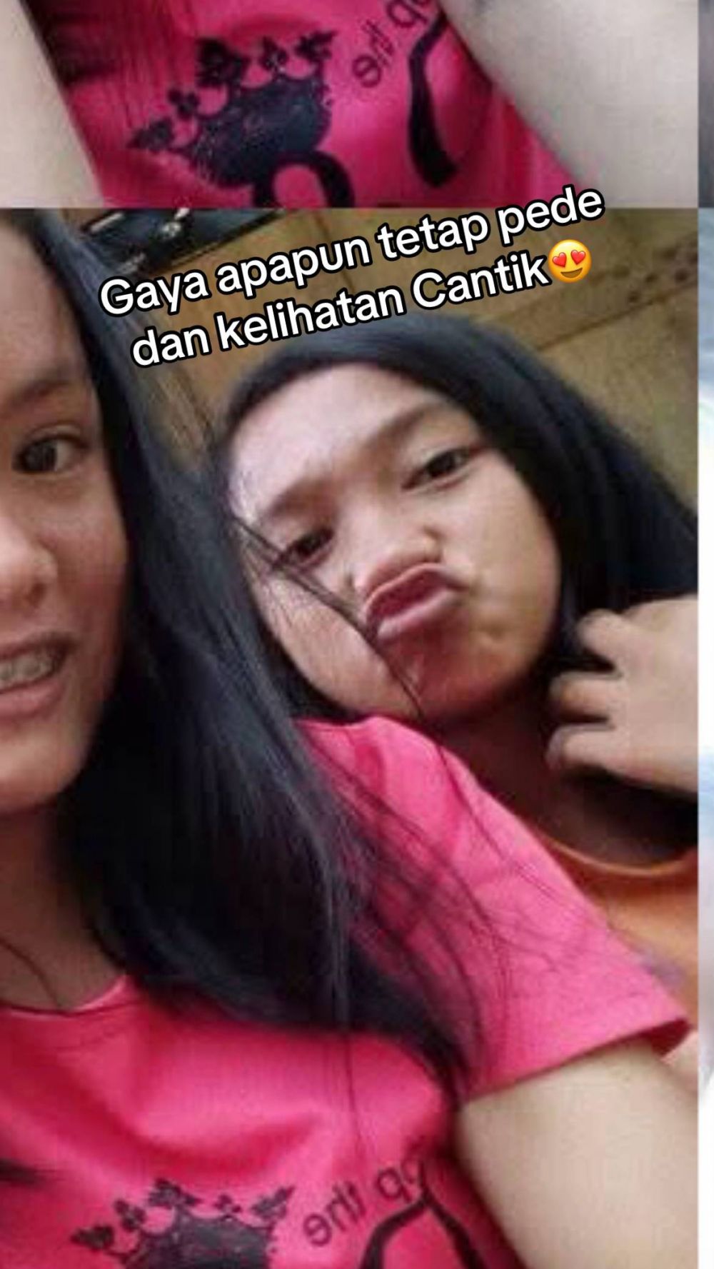 Menyesal pakai krim merkuri, 7 transformasi wajah wanita dulu mulus kini penuh bopeng ini bikin miris