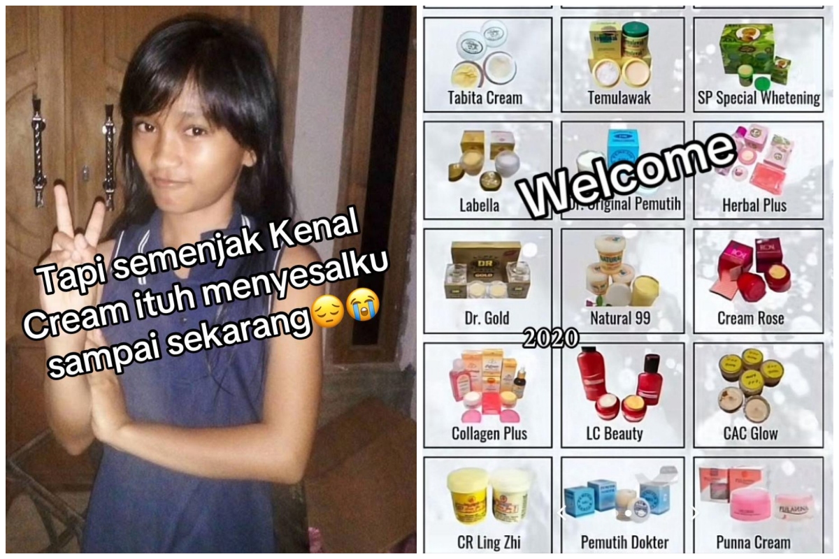 Menyesal pakai krim merkuri, 7 transformasi wajah wanita dulu mulus kini penuh bopeng ini bikin miris