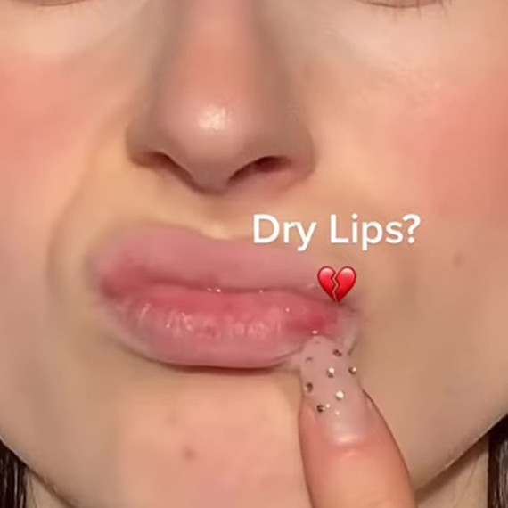 Bibir kering dan kusam? Begini cara mengatasinya agar lembap pakai lip mask dari 1 bahan pemanis