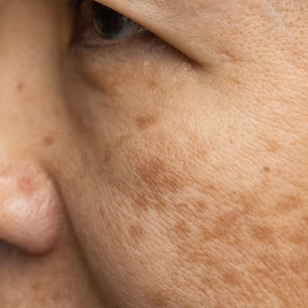 Trik samarkan kulit kendur dan keriput pakai bahan alami, bikin wajah auto cerah dan awet muda