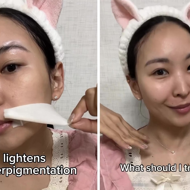 Ternyata jenis umbi-umbian ini ampuh cerahkan wajah dan atasi hiperpigmentasi, begini cara pakainya