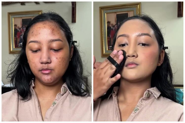 Transformasi remaja dengan bekas jerawat dirias soft glam ini hasilnya natural bak pakai second skin