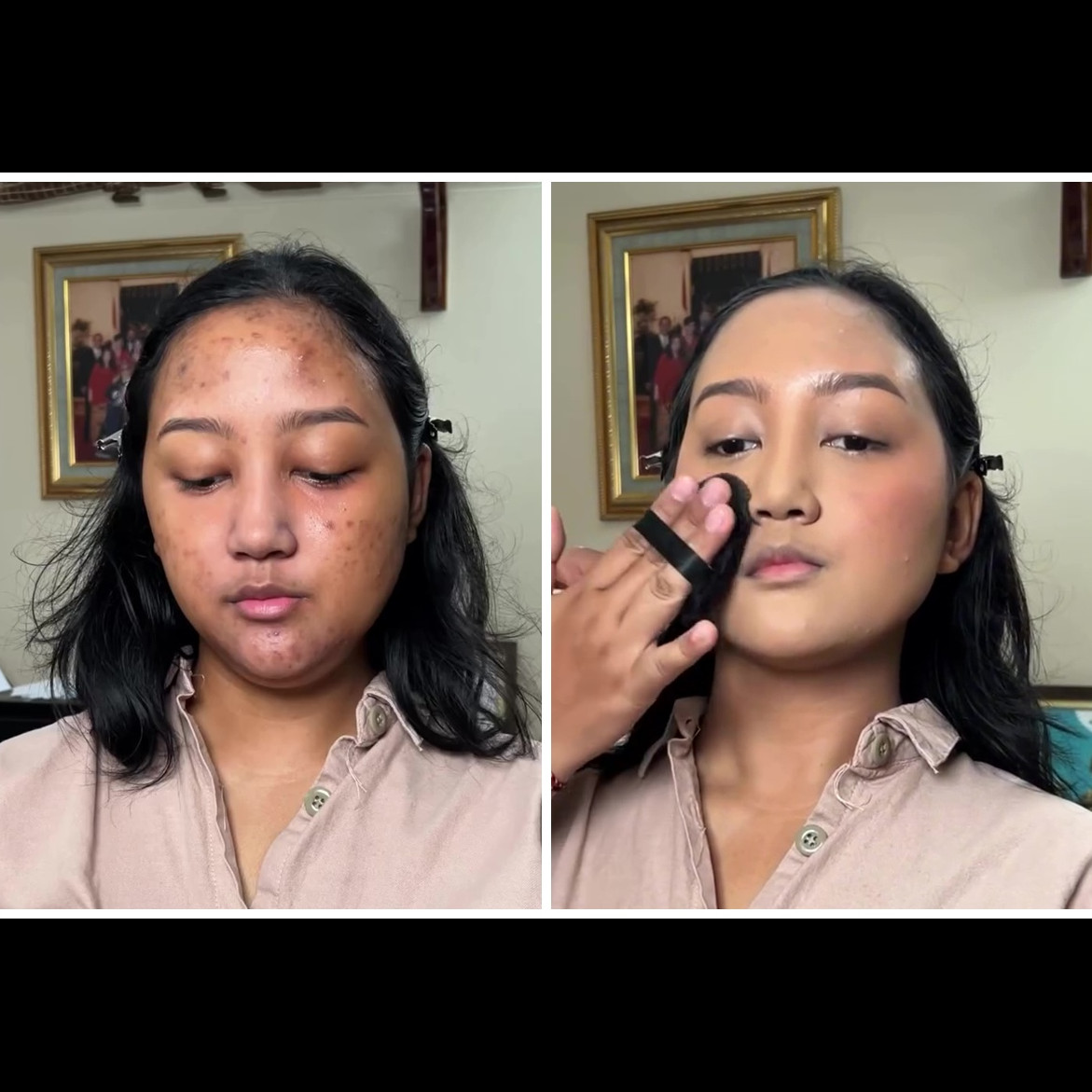 Transformasi remaja dengan bekas jerawat dirias soft glam ini hasilnya natural bak pakai second skin
