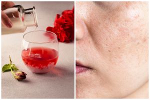 Tak cuma mencerahkan, begini cara pakai air mawar agar bantu kecilkan pori dan kontrol minyak wajah