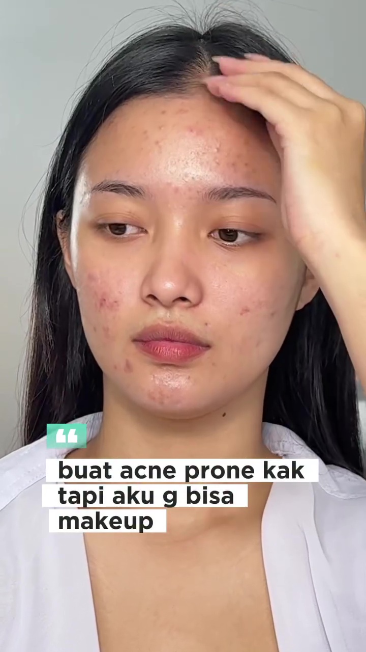 Padahal cuma pakai cushion, MUA ini sukses ubah wajah berjerawat jadi mulus alami bak hasil treatment
