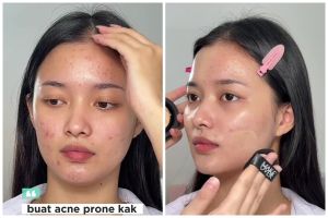 Padahal cuma pakai cushion, MUA ini sukses ubah wajah berjerawat jadi mulus alami bak hasil treatment