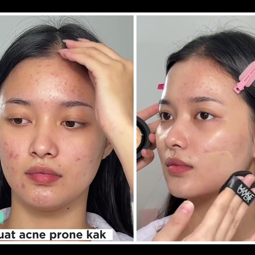 Padahal cuma pakai cushion, MUA ini sukses ubah wajah berjerawat jadi mulus alami bak hasil treatment