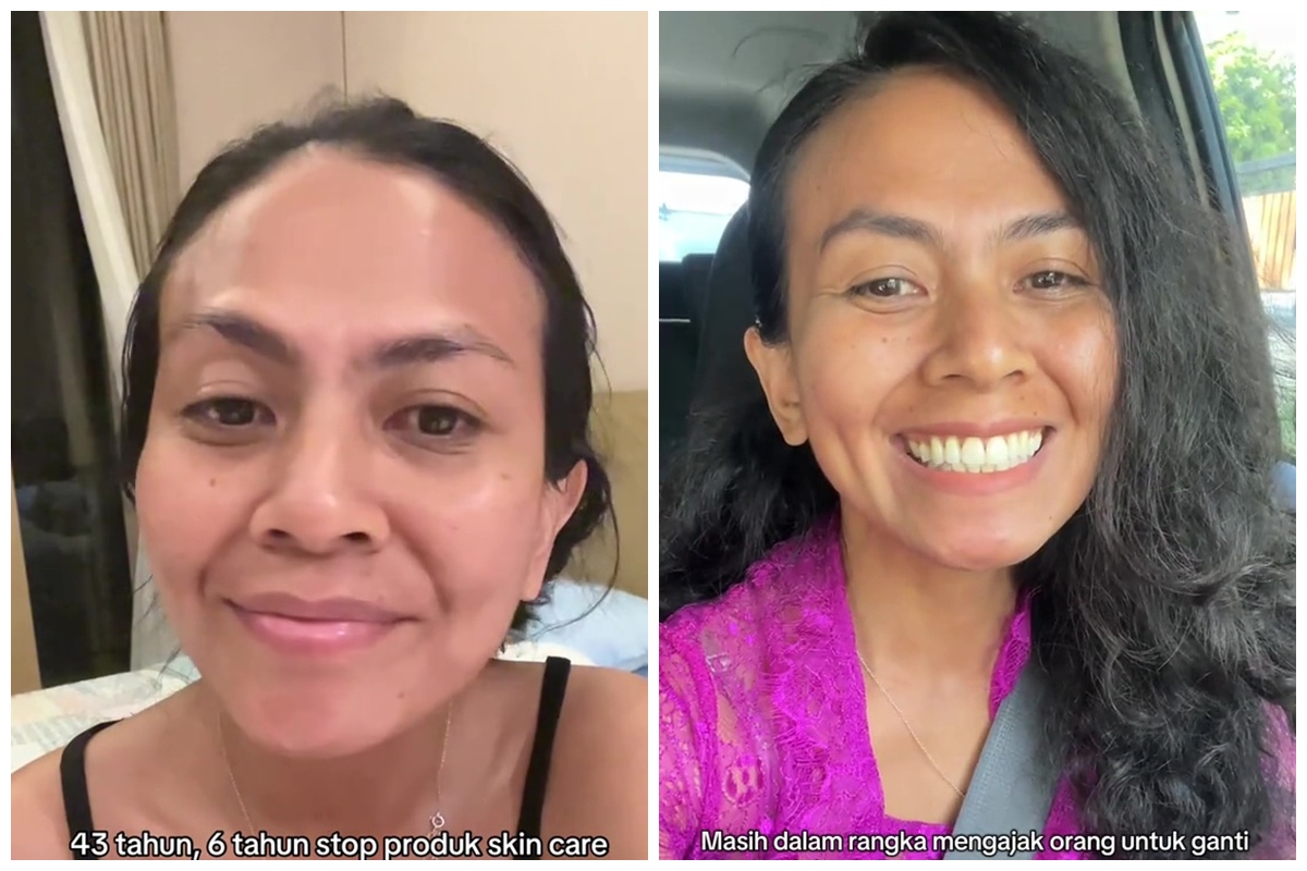 Kisah wanita 6 tahun lepas skincare dan 3 tahun tak pakai sunscreen, 7 potret hasilnya bikin takjub