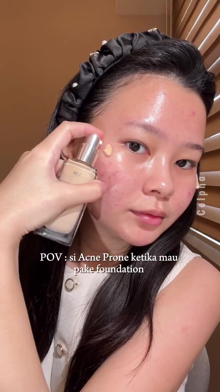 Tak perlu mix produk, ini cara pakai foundation di kulit berjerawat agar full coverage tanpa dempul